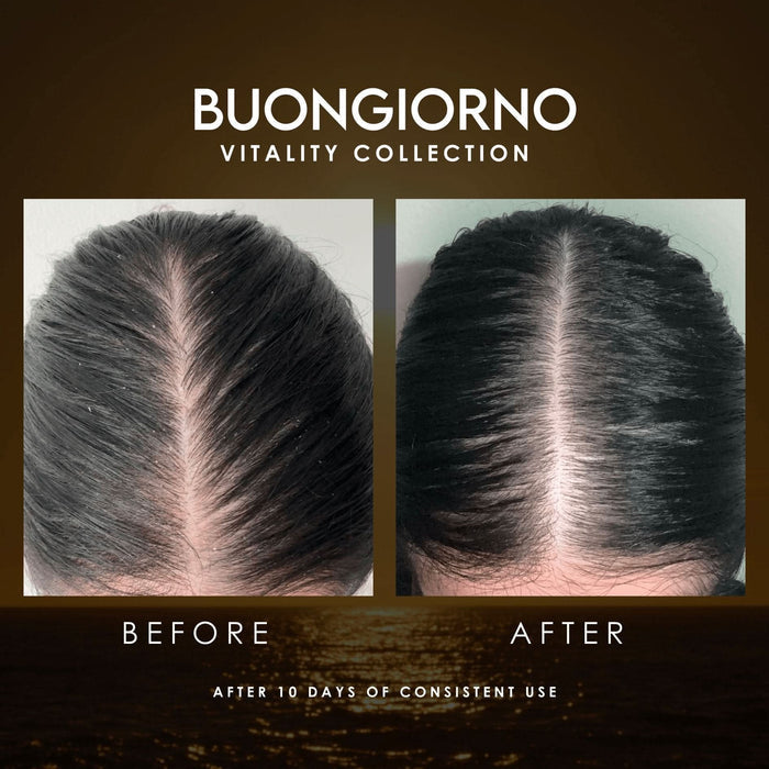 Before And After Improvement of Dandruff With Buongiorno
